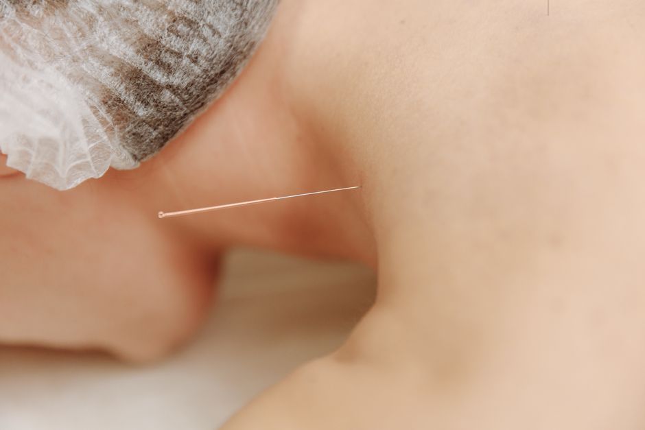 Moxibustion for Beginners: How to Use Moxa Sticks Safely at Home (Complete Guide)