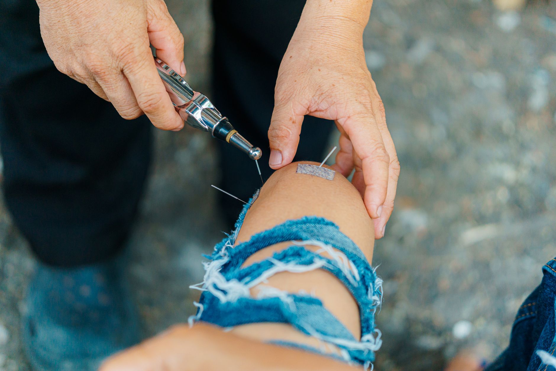 TCM for Knee Pain: Acupoints, Herbs, and the Wind-Damp Pattern Behind Arthritis